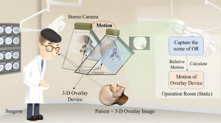 Moving-tolerant Augmented Reality Surgical Navigation System using Autostereoscopic 3D Image Overlay