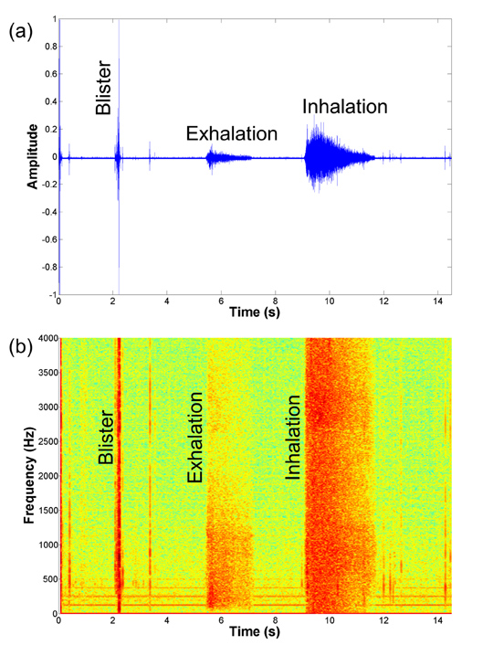 Audio signal (a) and corresponding spectrogram (b) of DiskusTM inhaler use showing the blister, exhalation and inhalation events.