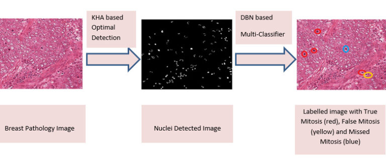 A Multi-Classifier System for Automatic Mitosis Detection in Breast Histopathology Images using Deep Belief Networks