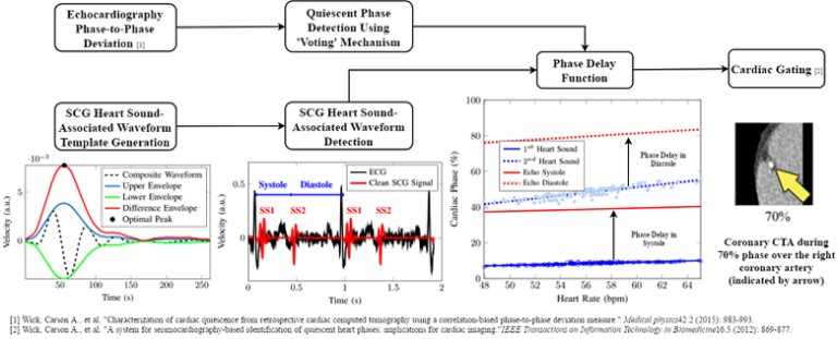 Seismocardiography-Based Cardiac Computed Tomography Gating Using Patient-Specific Template Identification and Detection
