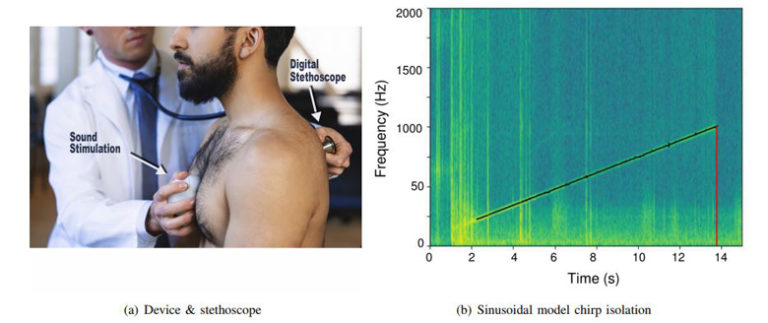 Improved Detection of Lung Fluid with Standardized Acoustic Stimulation of the Chest