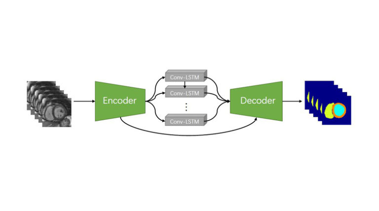 Cardiac-DeepIED: Automatic Pixel-level Deep Segmentation for Cardiac Bi-ventricle Using Improved End-to-End Encoder-Decoder Network
