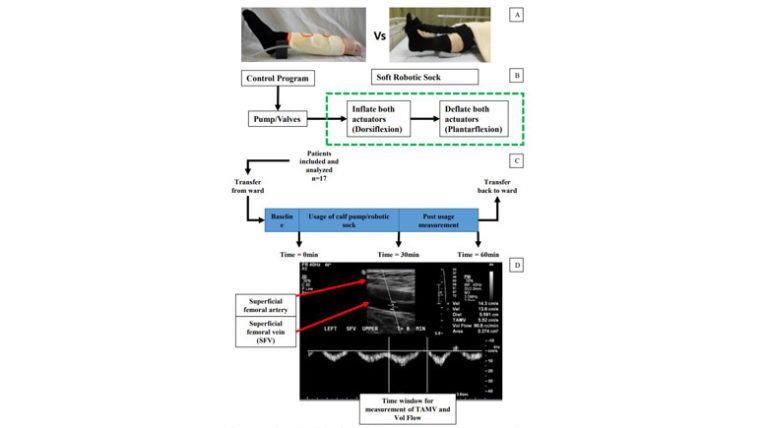 Effect of a Soft Robotic Sock Device on Lower Extremity Rehabilitation following Stroke: A Preliminary Clinical Study with Focus on Deep Vein Thrombosis Prevention
