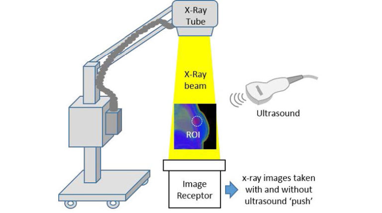 Elastographic Tomosynthesis from X-ray Strain Imaging of Breast Cancer