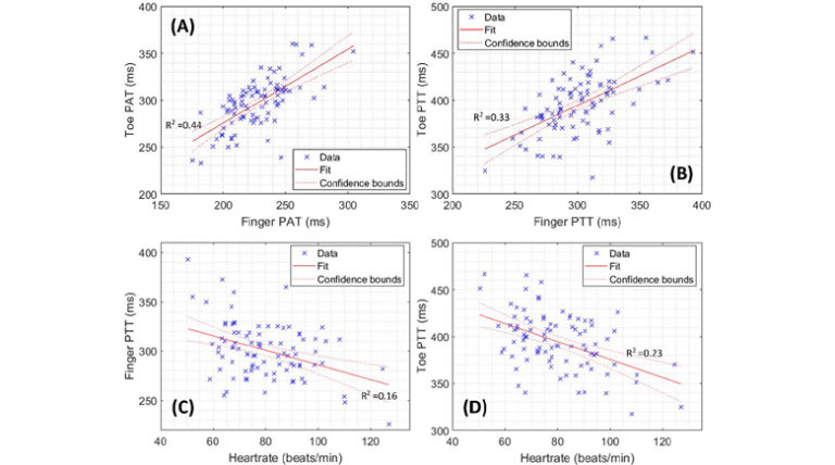 Sex-related Differences in Photoplethysmography Signals Measured from Finger and Toe