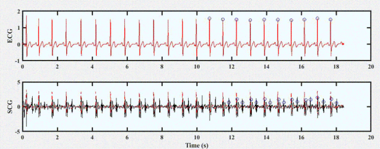 Near Real-Time Implementation of An Adaptive Seismocardiography — ECG Multimodal Framework for Cardiac Gating