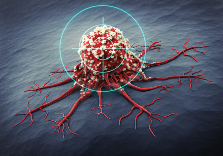 New Tests and Devices for Early Cancer Detection - IEEE Pulse
