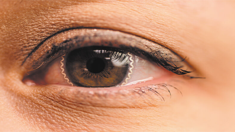 Smart Contact Lenses Keep an Eye on Health Figure 3