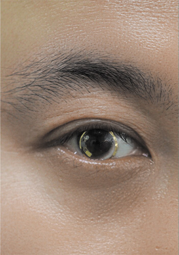 Smart Contact Lenses Keep an Eye on Health Figure 4
