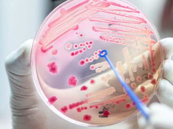 New Strategies for Addressing Antibiotic Resistance Offer Promise, but Time is Running Out 