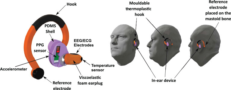 In Your Ear: A Multimodal Hearables Device for the Assessment of the State of Body and Mind