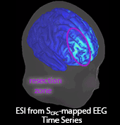 Epileptogenic Source Imaging Using Cross Frequency Coupled Signals from Scalp EEG