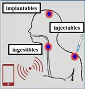 A Review of In-Body Biotelemetry Devices: Implantables, Ingestibles, and Injectables