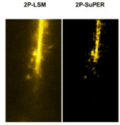 In Vivo Super-resolution Imaging of Neuronal Structure in the Mouse Brain