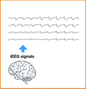 Estimating Brain Connectivity with Varying-Length Time Lags Using a Recurrent Neural Network