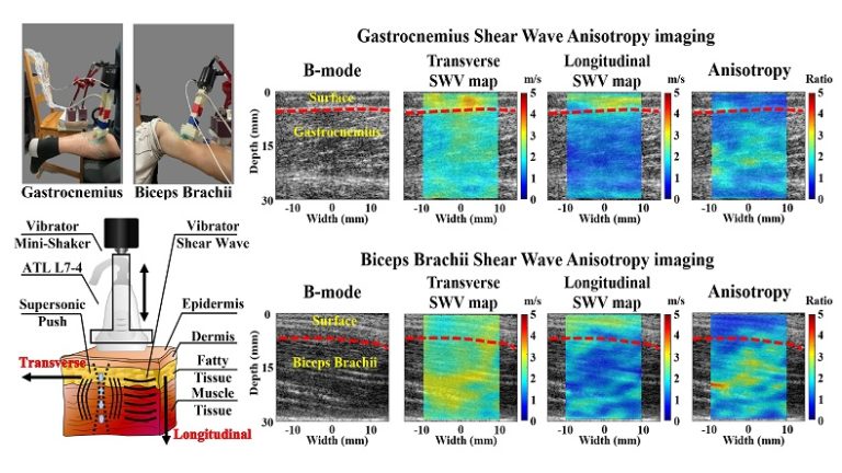 Visualization of Human Skeletal Muscle Mechanical Anisotropy by Using Dual-Direction Shear Wave Imaging