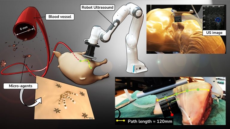 Intravascular Tracking of Micro-Agents Using Medical Ultrasound: Towards Clinical Applications