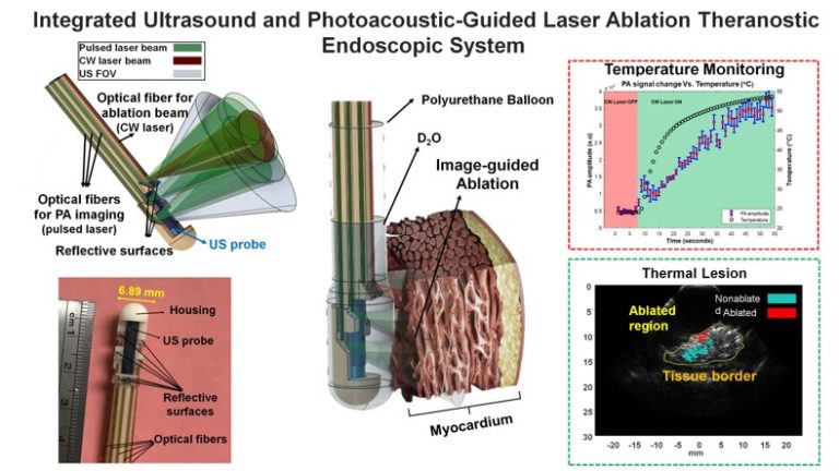 Integrated Ultrasound and Photoacoustic-guided Laser Ablation Theranostic Endoscopic System