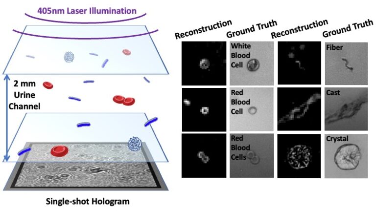 Lens Free Holographic Imaging for Urinary Tract Infection Screening