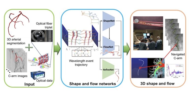 Shape and Flow Sensing in Arterial Image Guidance from UV Exposed Optical Fibers based on Spatio-temporal Networks