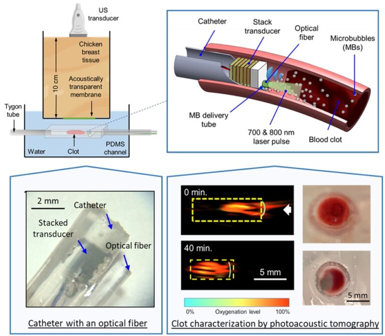 Miniaturized Stacked Transducer for Intravascular Sonothrombolysis with Internal-illumination Photoacoustic Imaging Guidance and Clot Characterization