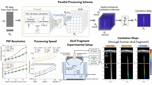 Real-Time Passive Acoustic Mapping With Enhanced Spatial Resolution in Neuronavigation-Guided Focused Ultrasound for Blood–Brain Barrier Opening