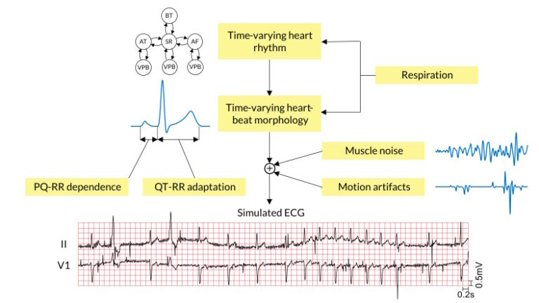 Simulation, Electrocardiogram, ECG Signals, Arrhythmias, Noise, Respiration, Data Augmentation