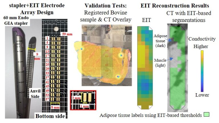 Development of an Electrical Impedance Tomography Coupled Surgical Stapler for Tissue Characterization