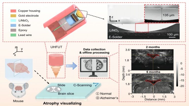 Ultra-High Frequency Self-Focusing Ultrasonic Sensors with Half-Concave Geometry for Visualization of Mouse Brain Atrophy