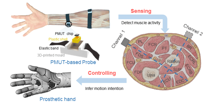 Sensing and Controlling Strategy for Upper Extremity Prosthetics Based on Piezoelectric Micromachined Ultrasound Transducer