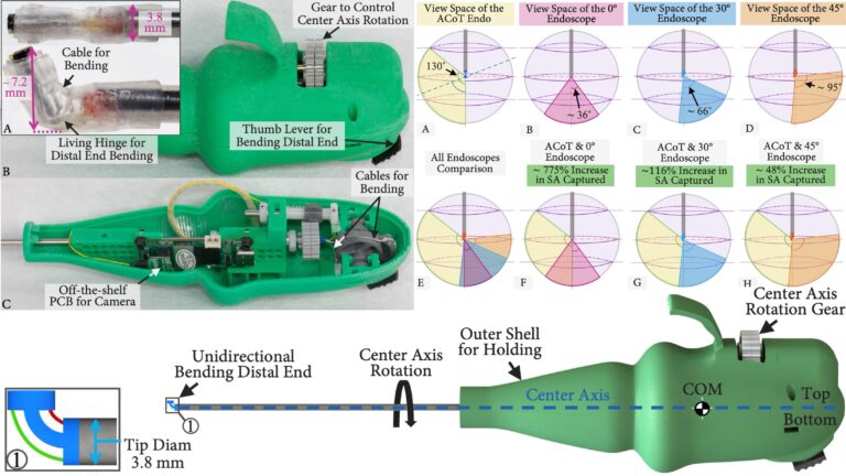 A Novel Articulating Chip–on–Tip Endoscope for Dynamic Middle Ear Surgical Visualization