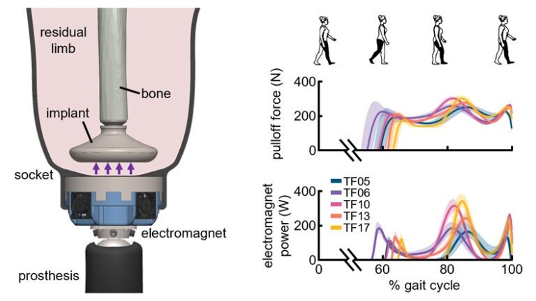 Prosthetic Limb Attachment via Electromagnetic Attraction through a Closed Skin Envelope