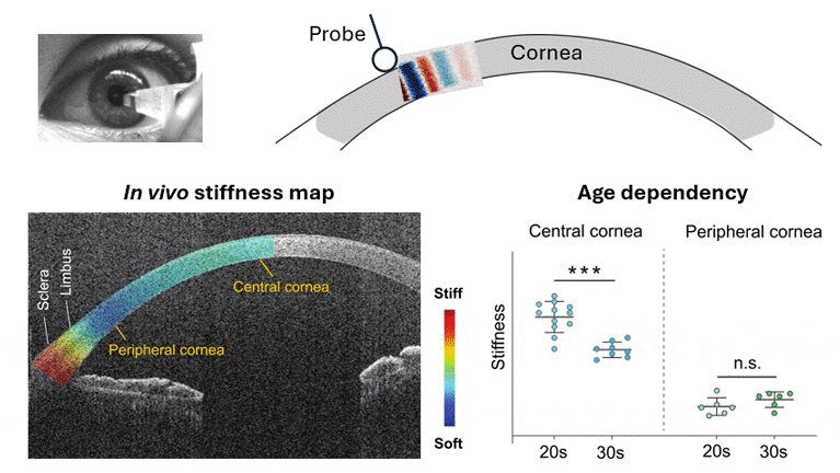 In Vivo Optical Coherence Elastography Unveils Spatial Variation of Human Corneal Stiffness