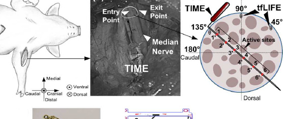 Stimulation Selectivity of the “Thin-Film Longitudinal Intrafascicular Electrode” (tfLIFE) and the “Transverse Intrafascicular Multi-Channel Electrode” (TIME) in the Large Nerve Animal Model
