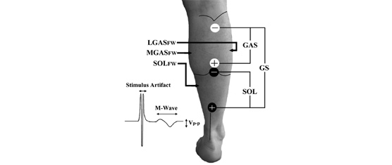 Fine-Wire Electromyography Response to Neuromuscular Electrical Stimulation in the Triceps Surae