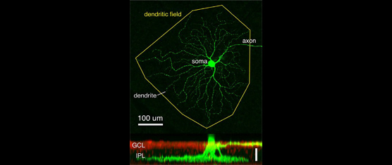 Optimizing the Electrical Stimulation of Retinal Ganglion Cells