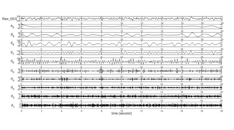 Epileptic Focus Localization Using Discrete Wavelet Transform Based on Interictal Intracranial EEG