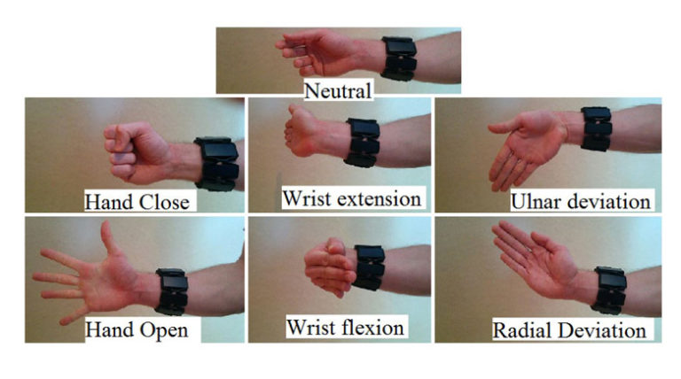 Deep Learning for Electromyographic Hand Gesture Signal Classification Using Transfer Learning