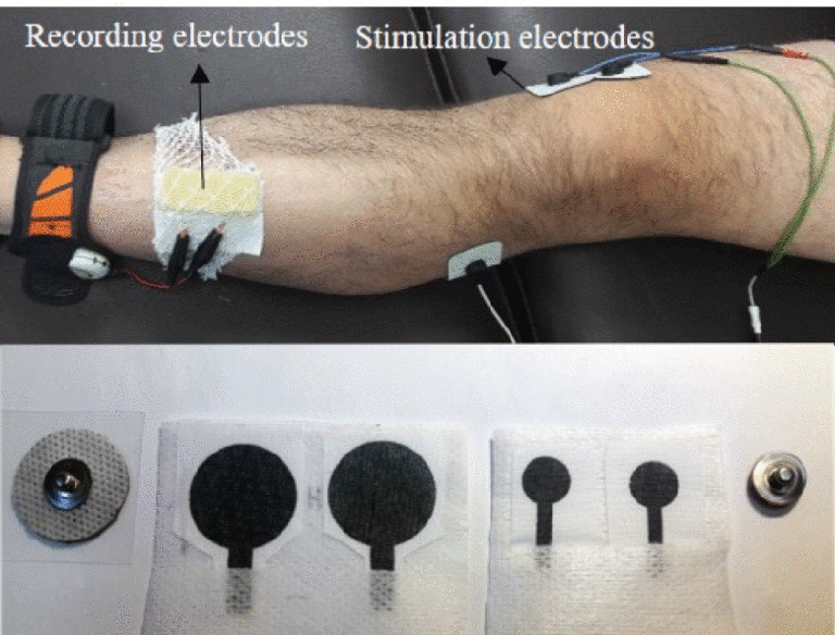 Validation of Polymer-Based Screen-Printed Textile Electrodes for Surface EMG Detection