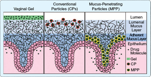 FIGURE S4 Hanes’s research group has developed nanoparticles that can get drugs past the body’s protective mucus layer (blue) and to underlying diseased tissues (pink), where they can have maximal effect. This image contrasts the ability of drug-­carrying gels and conventional particles with his group’s mucus-penetrating particles to diffuse through the mucus layer in vaginal tissue. (Image used with permission from [1].)