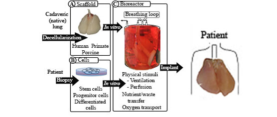 Strategies for Whole Lung Tissue Engineering