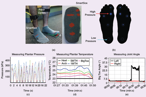 FIGURE 2: SALSA researchers are developing socks, called SmartSox, that are made of intelligent textiles. Through the use of fiber optics and sensors [shown in red in (a)], the socks measure the (b) and (c) pressure and (d) temperature on the sole of the feet and (e) the joint angle. Alerts of problem areas can be sent to diabetic patients and their medical professionals as an early warning system to prevent the development of foot ulcers. The Chicago-based start-up company, Novinoor LLC, is working to commercialize the socks for use in a medical setting. (Images courtesy of the University of Arizona College of Medicine.)