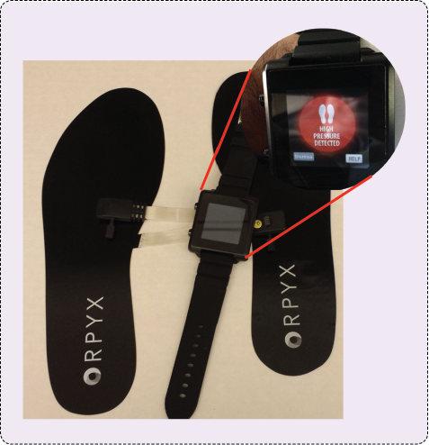 FIGURE 3: Designed by Calgary company Orpyx and in validation at SALSA, this smart insole detects potentially ulcer-producing pressure and alerts the patient through a wrist device. Technologies like these are designed so that diabetic patients can become involved in the care of their own health. (Image courtesy of the University of Arizona College of Medicine.)