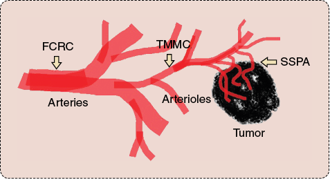 FIGURE 1: A simple schematic shows the general path for direct targeting to a solid tumor. In the arteries with a diameter up to a few millimeters and a blood flow velocity reaching tens of centimeters per second, a special catheter, dubbed the FCRC, is placed as deep as possible along the arterial network. Then, TMMCs with overall diameters of just a few tens of micrometers are released from the FCRC and magnetically navigated along a predefined path until embolization occurs deep in the arterioles. At this moment, the drug is released in case of chemoembolization, or drug-loaded SSPAs encapsulated in special TMMCs are released prior to transit through the capillaries and the angiogenesis network to deliver the therapeutics deep in the tumor.