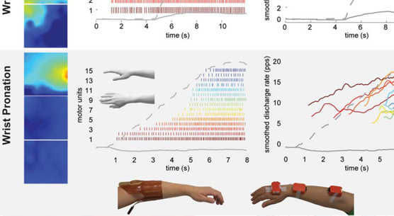 The Extraction of Neural Information from the Surface EMG for the Control of Upper-Limb Prostheses: Emerging Avenues and Challenges
