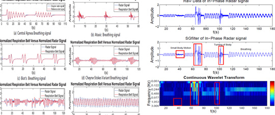 Monitoring and Analysis of Respiratory Patterns using microwave Doppler radar