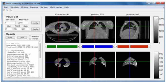 Automated Lung Segmentation and Image Quality Assessment for Clinical 3-D/4-D-Computed Tomography