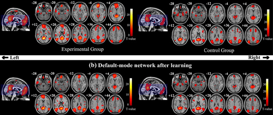 Motor Imagery Learning Induced Changes in Functional Connectivity of the Default Mode Network