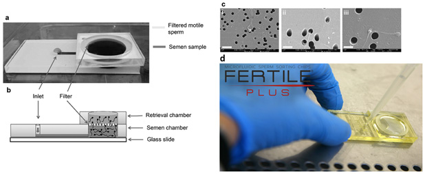 Figure 3. Selection of functional and motile human sperm on-chip. a) Micrograph of sperm sorting microchip. b) Principle of sperm sorting microchips. Once injected into the inlet, the most motile and healthy sperm can swim the filter membrane with a pore size of 3, 5 or 8 μm. c) SEM images of sperm passed through polycarbonate nuclepore track-etched membrane i) 3 μm, ii) 5 μm, and iii) 8 μm. The scale bar is 10 μm (Reproduced from Ref. Asghar et al. 2014 with permission). d) FERTILE PLUS-IUI product.