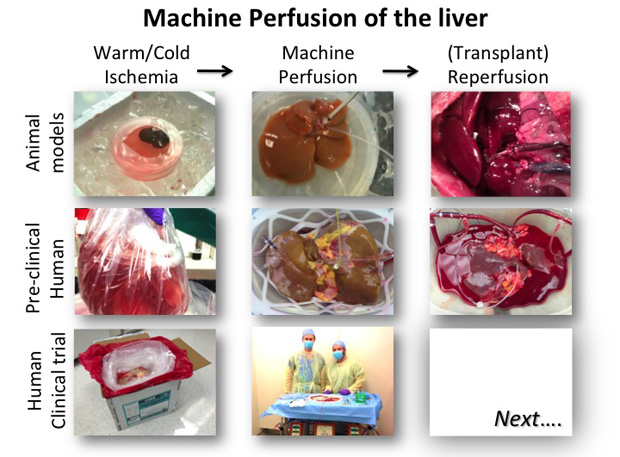 Stepwise translation of machine perfusion over different models of transplantation, leading to eventual clinical application.